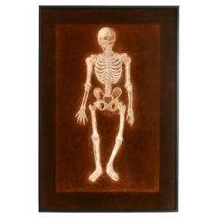Alain Gerard Clement Silver Gelatin Photogenic Image Human Skeleton